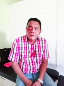 Aclaración de hechos violentos de los que fui víctima de parte de Alberto Hernández