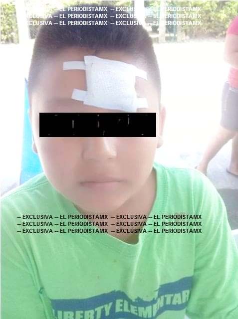 En riña de cantina terminó herido accidentalmente un niño en Huehuetán