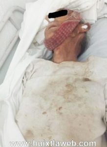 Abuelito muere al caer a pozo en Escuintla