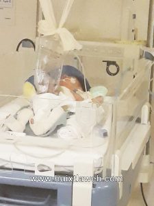 Se recupera en el pediátrico de Tuxtla niño que nació con intestinos de fuera 