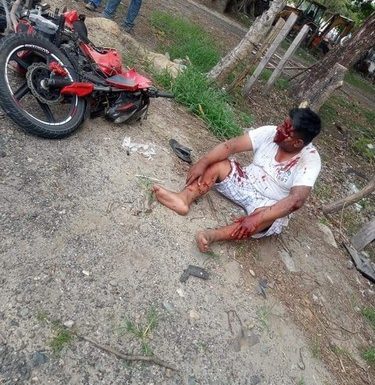 Dos lesionados al chocar motociclistas