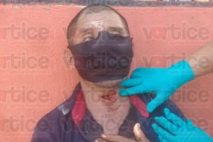 Casi lo degüellan con un machete al oponerse a un asalto