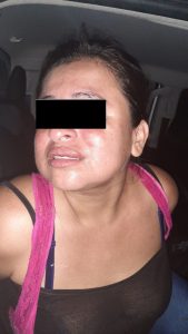 En Tapachula Policía Municipal detuvo a mujer por el delito de lesiones