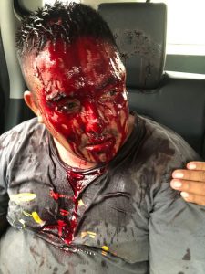 Personas lesionadas en enfrentamiento entre el PVEM y Chiapas Unido en Huehuetán 