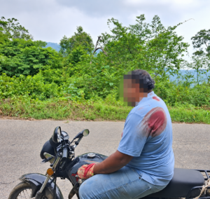 Motociclista-resulta-con-fuerte-lesio¦un-tras-derrapar-en-camino-a-La-Polka1